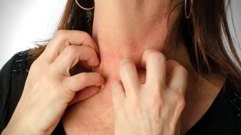 آیا حساسیت به طلا خطرناک است؟